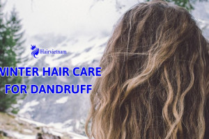 Winter Hair Care for Dandruff: Tips for Healthy Hair